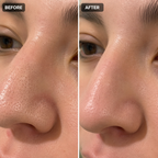 Blackhead Mud Mask