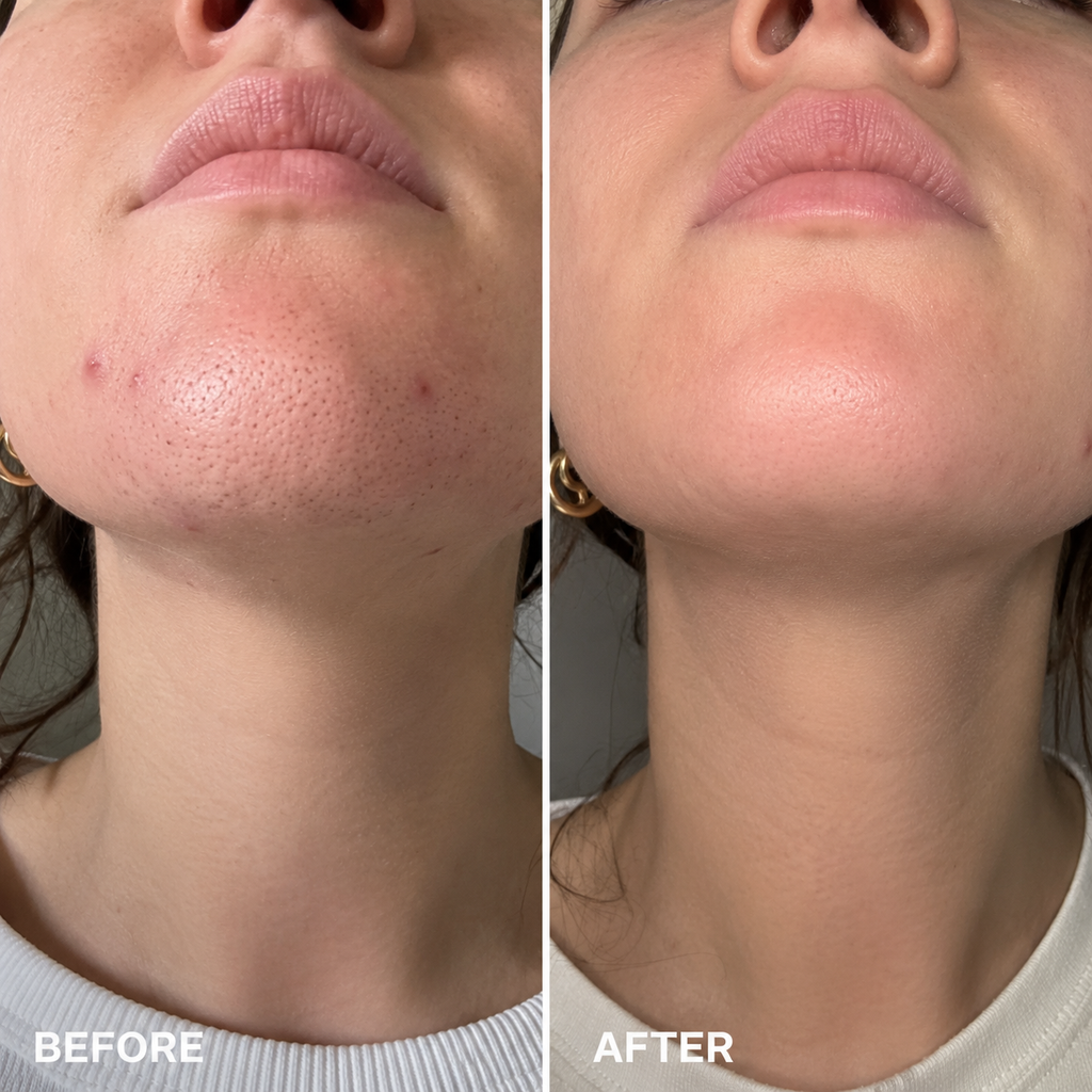 Blackhead Mud Mask